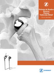 Bigliani Flatow Sistema de Hombro Reverso Zimmer Trabecular Metal 