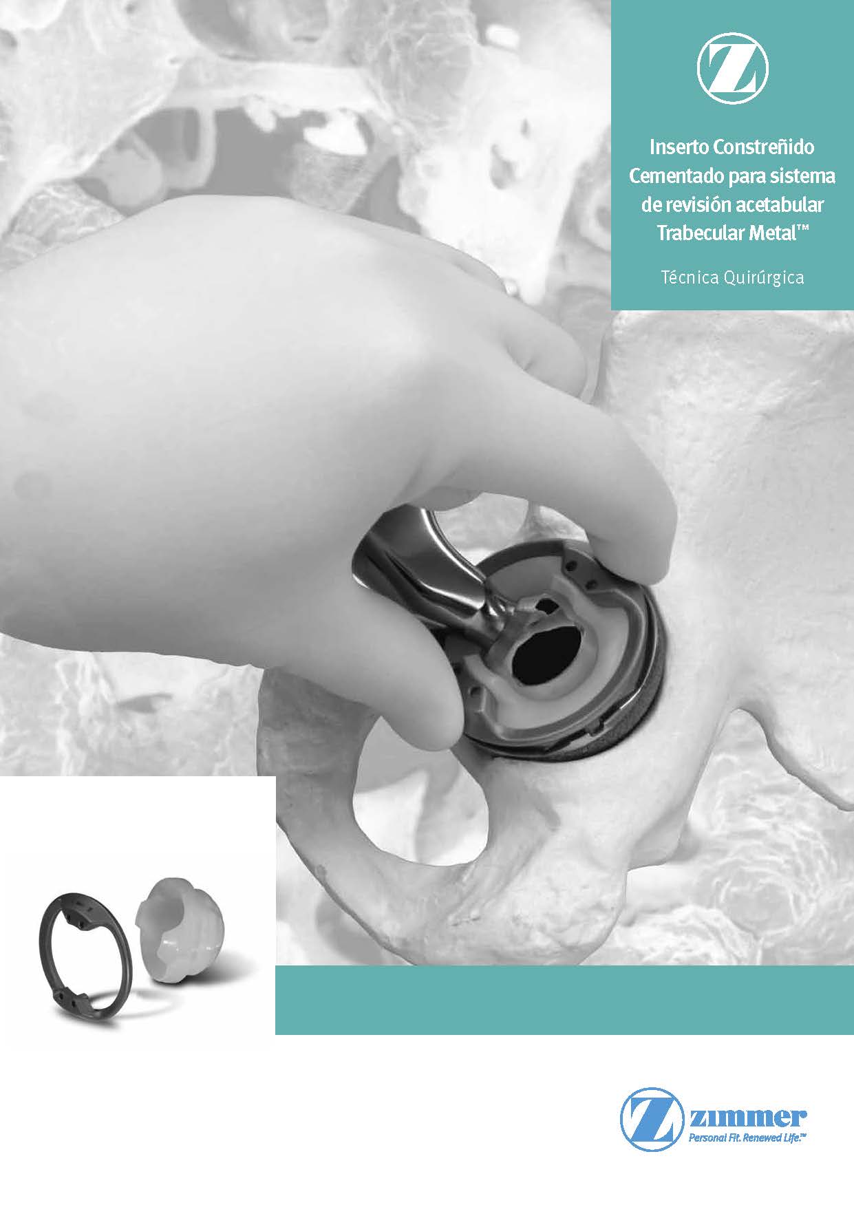 Fiber Metal Taper Inserto Cotilo Constreñido Cementado para Revisión Acetabular         